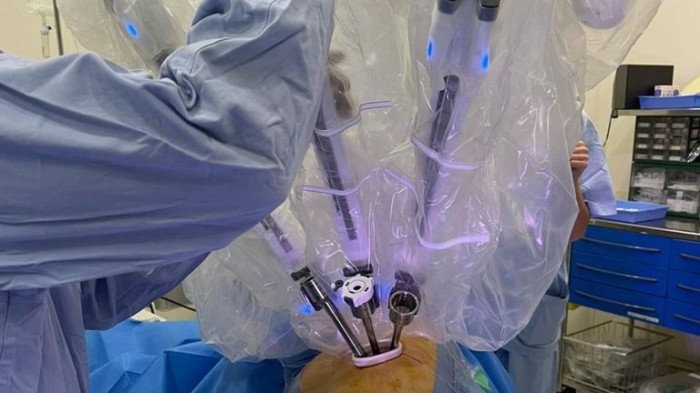 Galicia is pioneer in the world performing single port robotic lung surgery 